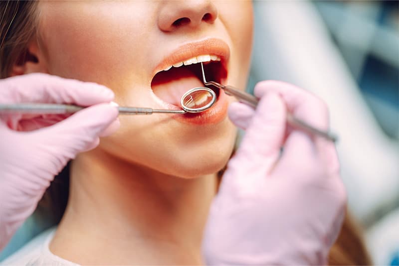 Cross-section illustration of tooth cavity